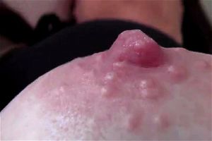 Masturbation