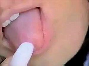 Anal thumbnail