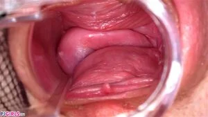 Pussy Close Up, Gape Vagina, Cervix  thumbnail