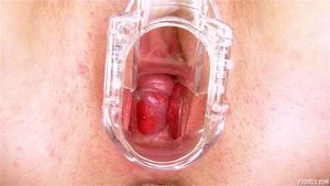 Pussy Close Up, Gape Vagina, Cervix  thumbnail