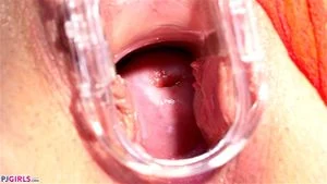 CERVIX miniatura