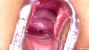 Pussy Close Up, Gape Vagina, Cervix  thumbnail