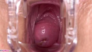 Pussy Close Up, Gape Vagina, Cervix  thumbnail