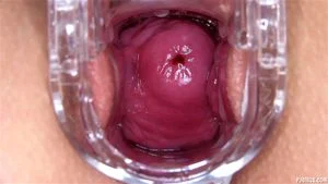 Cervix thumbnail