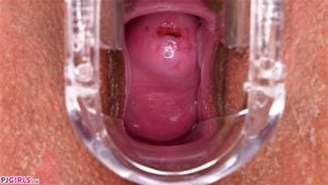 CERVIX thumbnail