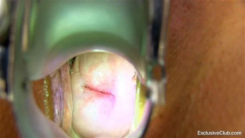 Natali Gyno ft. Natali Sweets: Fansly, Speculum & Cervix Closeup Porn