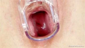 Vaginal Speculums thumbnail