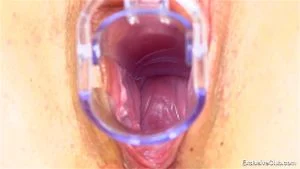 Doctor - Gyno thumbnail