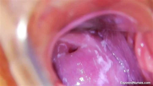 Keira Gyno: Xnxx, Nurse & Speculum Porn