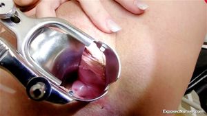 Speculum thumbnail