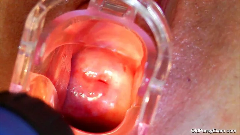 Osla Gyno Osla Gyno