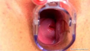 cervix thumbnail