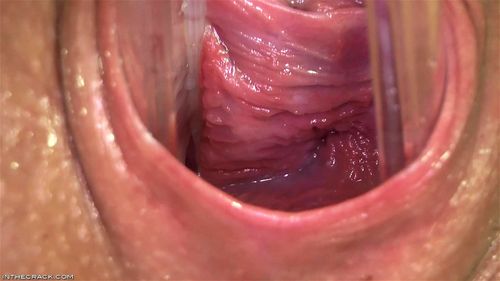 Puddle around her Cervix