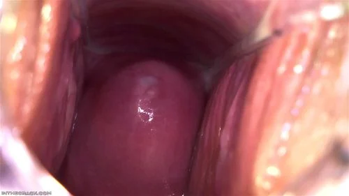 Puddle around her Cervix