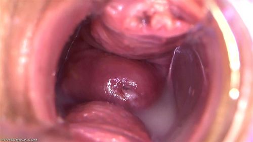 Puddle around her Cervix