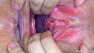Vaginal Speculums thumbnail