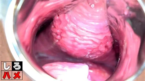 Pregnant A