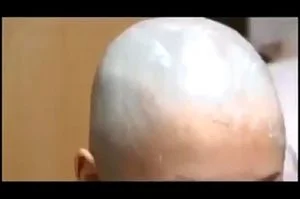 Bald thumbnail