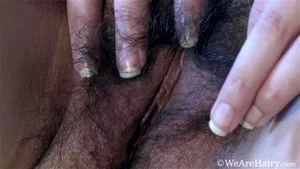 Hairy thumbnail