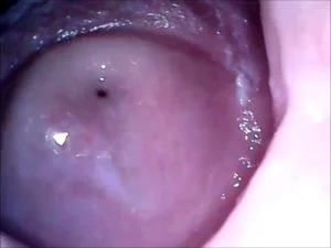 Pussy Close Up, Gape Vagina, Cervix  thumbnail