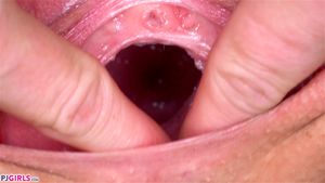 CERVIX thumbnail