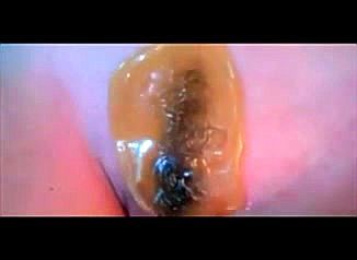 Brazilian Wax Training. - Training, Brazilian Waxing Female, Amateur Porn - SpankBang