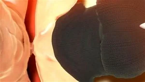 Miconisomi and Insult order thumbnail