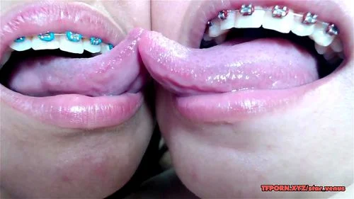 Deep tounge kissing between two brace lesbian
