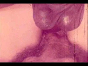 Double Vaginal thumbnail