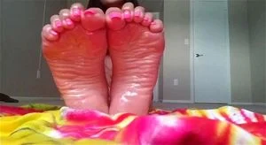 Long toenails thumbnail