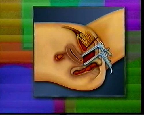 Real GYN Exam Training