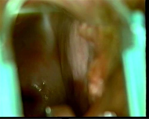Real GYN Exam Training