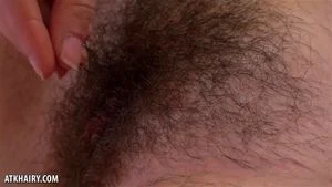 Hairy thumbnail