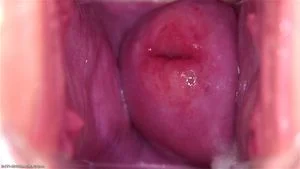 Pussy Close Up, Gape Vagina, Cervix  küçük resim