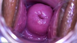 Pussy Close Up, Gape Vagina, Cervix  thumbnail