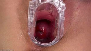 Pussy Close Up, Gape Vagina, Cervix  thumbnail