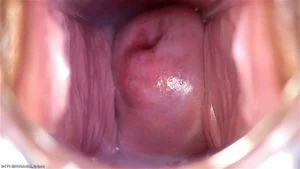 Pussy Close Up, Gape Vagina, Cervix  thumbnail