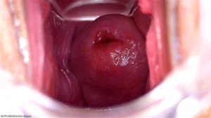 Vaginal Speculums thumbnail