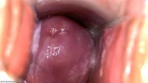 Speculum thumbnail