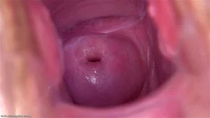 Pussy Close Up, Gape Vagina, Cervix  thumbnail