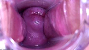 Pussy Close Up, Gape Vagina, Cervix  imej kecil