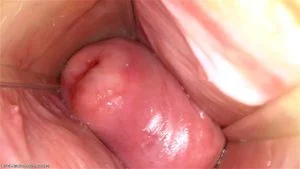 Vaginal Speculums thumbnail