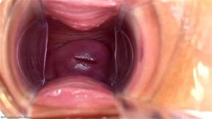 Vaginal Speculums thumbnail