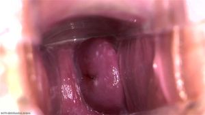 Pussy Close Up, Gape Vagina, Cervix  thumbnail