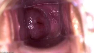 Vaginal Speculums thumbnail