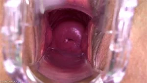 Pussy Close Up, Gape Vagina, Cervix  thumbnail