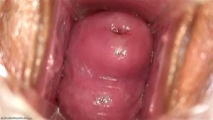 Pussy Close Up, Gape Vagina, Cervix  thumbnail