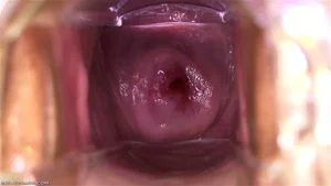 Speculum thumbnail