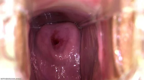 Iwia Pussy Show: Closeup, Speculum & Cervix Porn