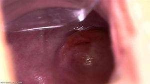 Pussy Close Up, Gape Vagina, Cervix  thumbnail